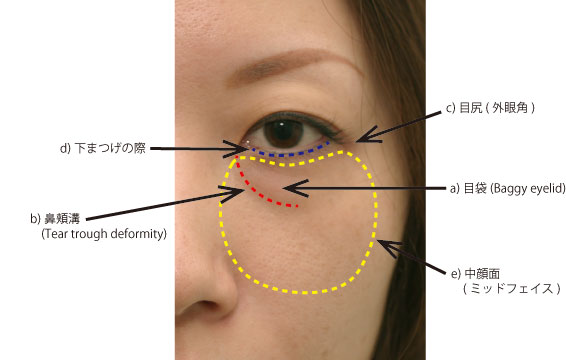 下眼瞼の名称の参考図説
